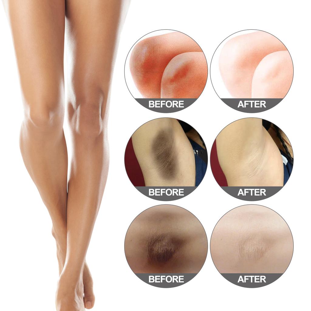 Jaysuing Brightening Cream – Repairs Dark Underarms, Knees & Elbows