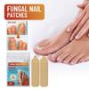 Toe Care Strips Repair Bunion Nail Rotten Toenail Soft Nail Ingrown Nail Nail Care Strips