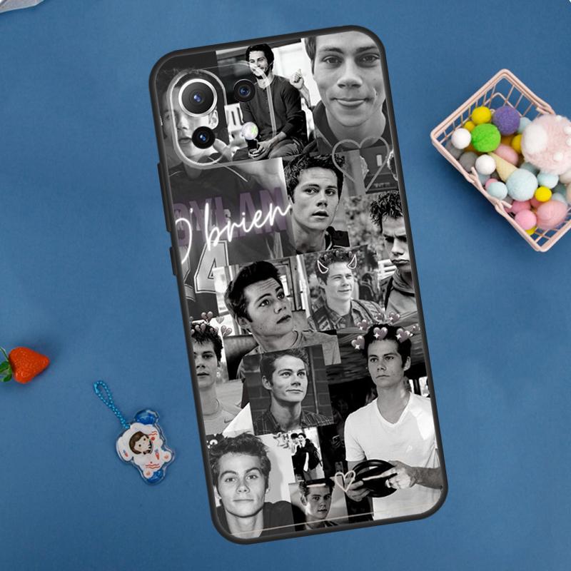 Dylan O'Brien Teen Wolf Case For Xiaomi 14 13 15 Ultra 11T 12T 13T 14T Pro POCO X7 Pro X3 X5 F5 F6 M6 X6 Pro Cover