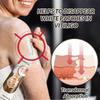 Vitiligo Cream, Anti-Vitiligo Cream, Reduce White Spots and Improve Skin Pigmentation, 20g