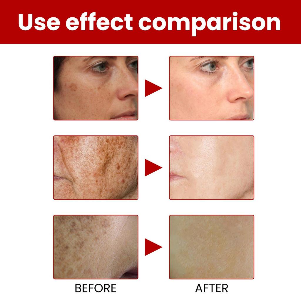 OUHOE Facial Care Cream, fades dark spots, hydrates and moisturizes, nourishes and repairs skin, brightens and whitens. Suitable for facial use, 20g.