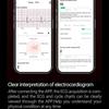 2025 Nový Health Trackr Kyselina močová Krevní lipidy Chytré hodinky Krevní tlak EKG+PPG Hodinky Analýza těla Chytré hodinky Muži Detekce emocí