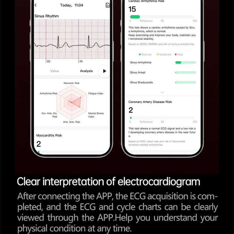 2025 Nový Health Trackr Kyselina močová Krevní lipidy Chytré hodinky Krevní tlak EKG+PPG Hodinky Analýza těla Chytré hodinky Muži Detekce emocí