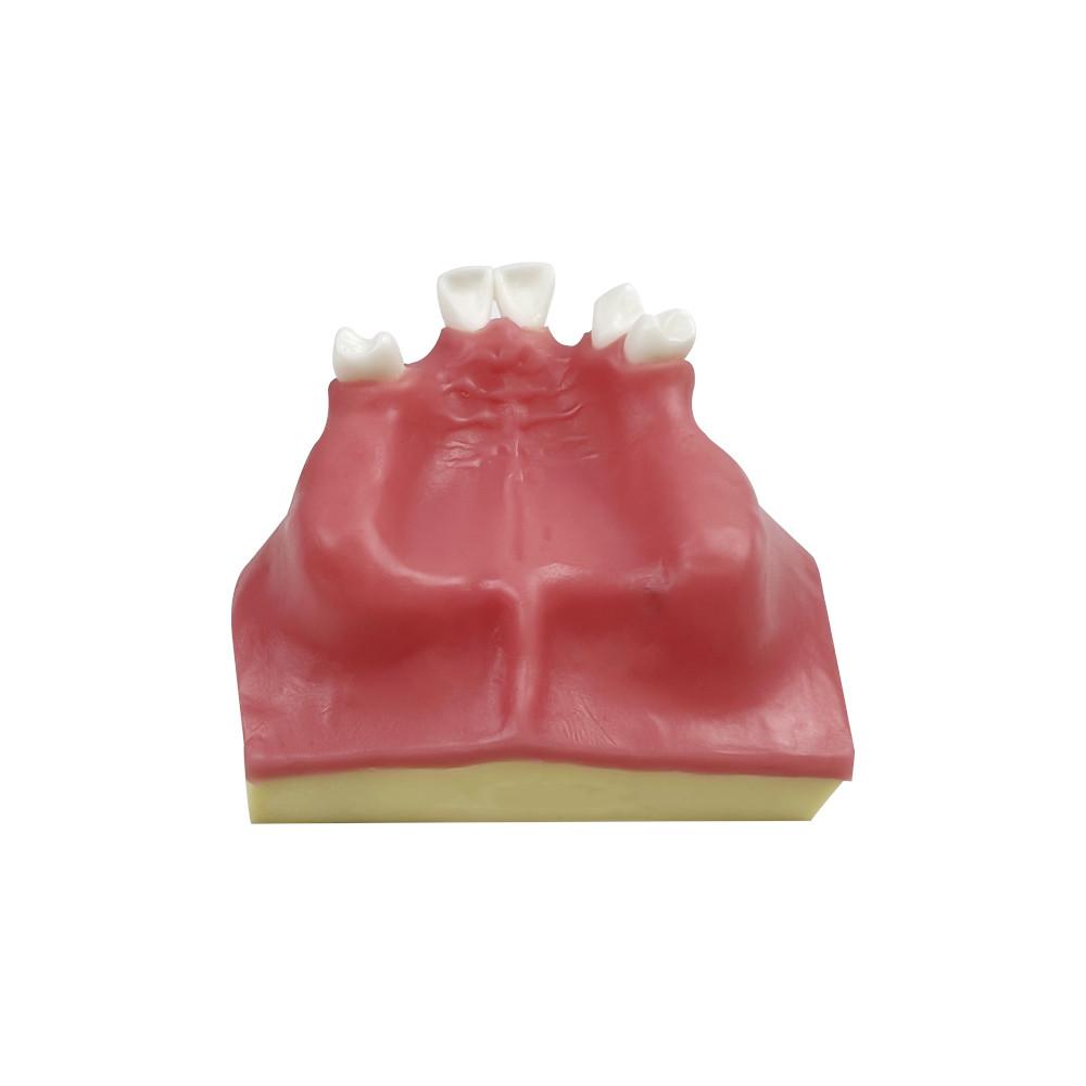Dental Practice Model Maxillary Sinus Implant Model With Soft Gums Teeth Studying Teaching Oral Medical Communication Tools