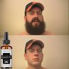 Silný olej na růst vousů pro muže pro růst vlasů Esenciální oleje Essence Anti Alopecia Více produktů proti vypadávání vlasů