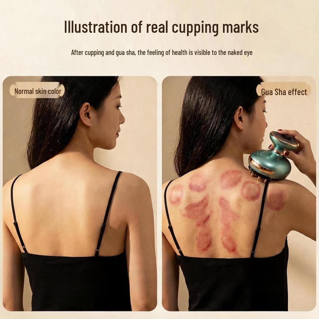 35-Speed EMS Microcurrent Full Body Gua Sha & Cupping Massager