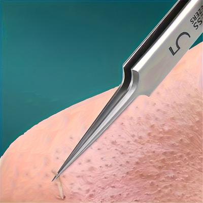 Mitesser-Clip-Pinzette mit ultrafeinen Zellen, zur Entfernung von Akne, Nadeln, Mitesser-Tiefenreiniger, Clip, Gesichtspflege-Tool für den Schönheitssalon