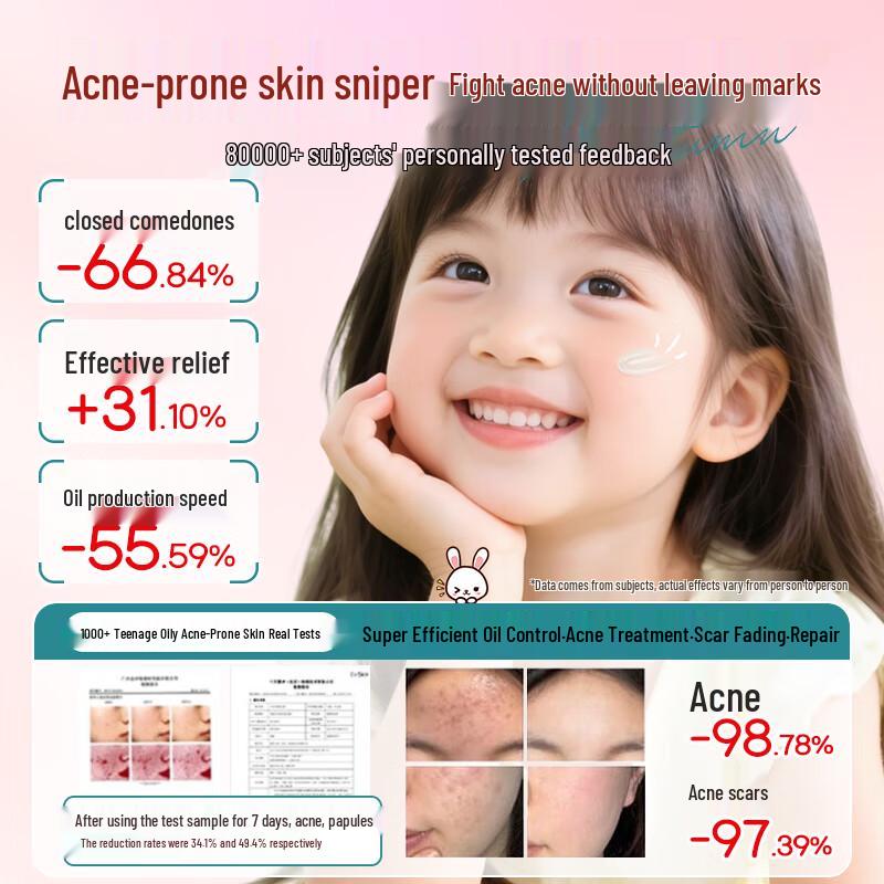 FIVERAMS Teen Acne Treatment Cream 30g