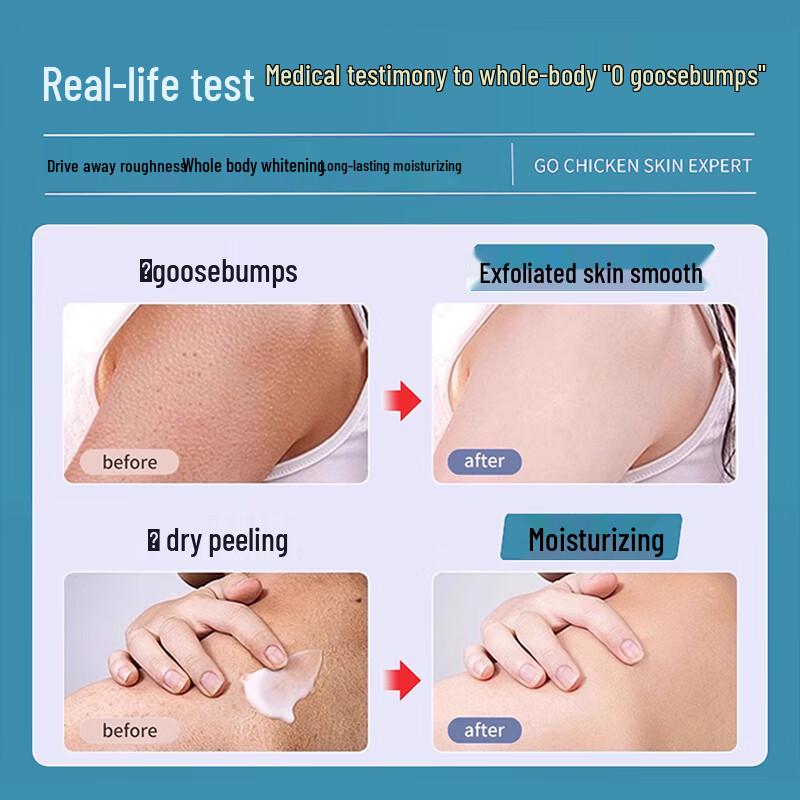 Behandlungskörperseife für Keratosis Pilaris