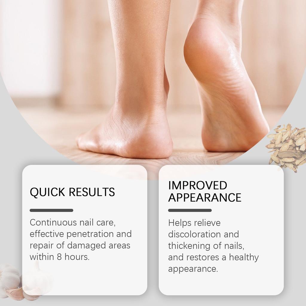 Ximonth Nagelreparatur-Pflaster Sanfte Pflegende Formel Für Hände Und Füße Natürlicher Glanz