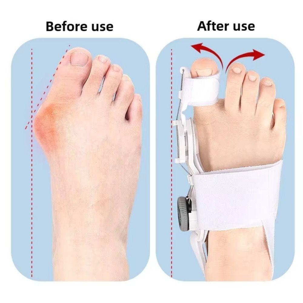 Rotatable Bunion Corrector Toe Valgus Foot Correction Brace Big Toe Straightener  Outdoor