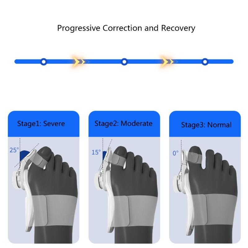 Orthopedic Toe Straightener Splint For Bunions Relief And Foot Pains Correction Design
