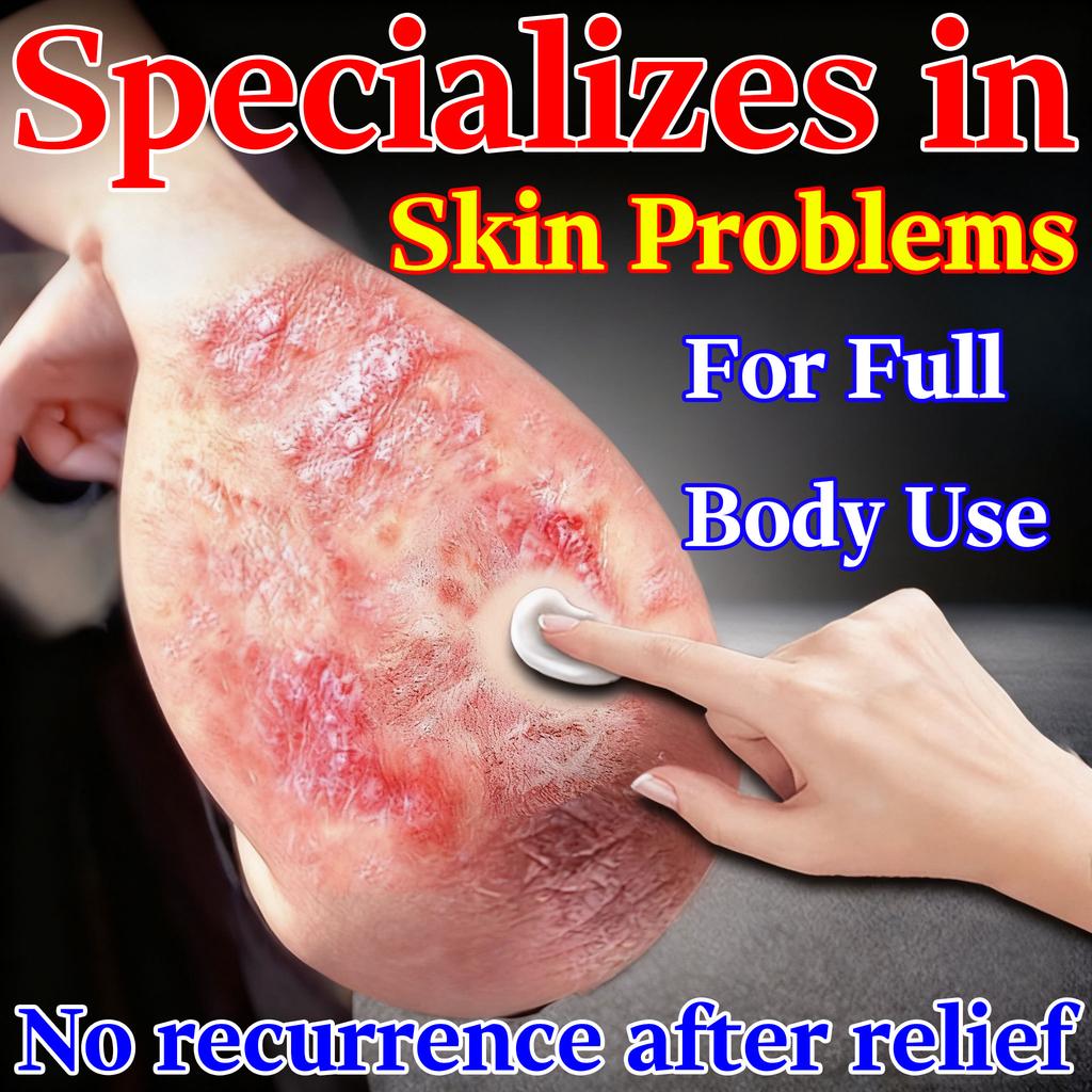 Eczema & Dermatitis Serum - Natural Herbs Soothes Skin Issues Gentle Application