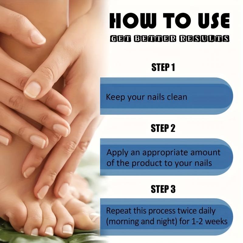 Nail Care Cream, Safe and Gentle for Repairing Nails On Hands, Feet, and Toes, Removing Nail Fungi, Repairing and Caring for Paronychia