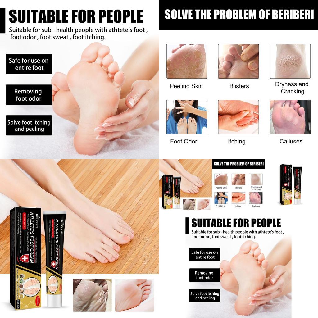 Ximonth Foot Odor Removal Cream With Soothing Formula For Itchy And Dry Skin Care