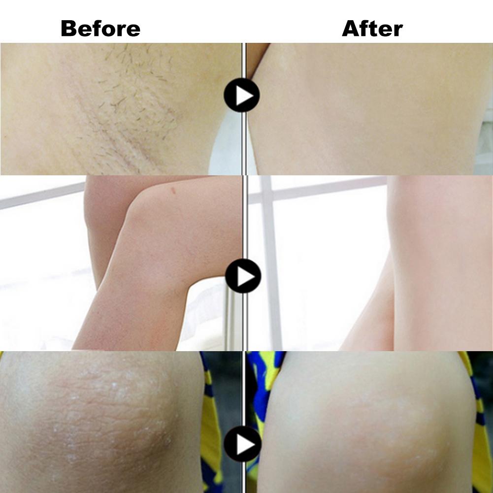 Whitening Skin Beauty Bleaching Lightening Moisturizing Intimate Private Body Care Soap