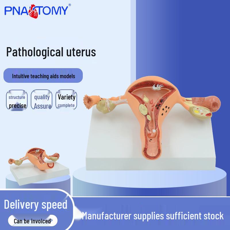Female Reproductive System Model: Uterus, Vagina, Ovary Teaching Aid 11*11*10 cm