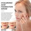 Hydrate & Rejuvenate - Hyaluronic Acid Face Serum for Soothing Dry Skin, Boosts Elasticity, Fights Acne, Erases Fine Lines