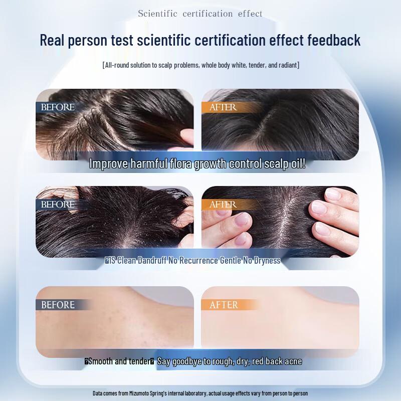 Shuimu Spring Salicylic Acid Deep Cleansing Shower Gel