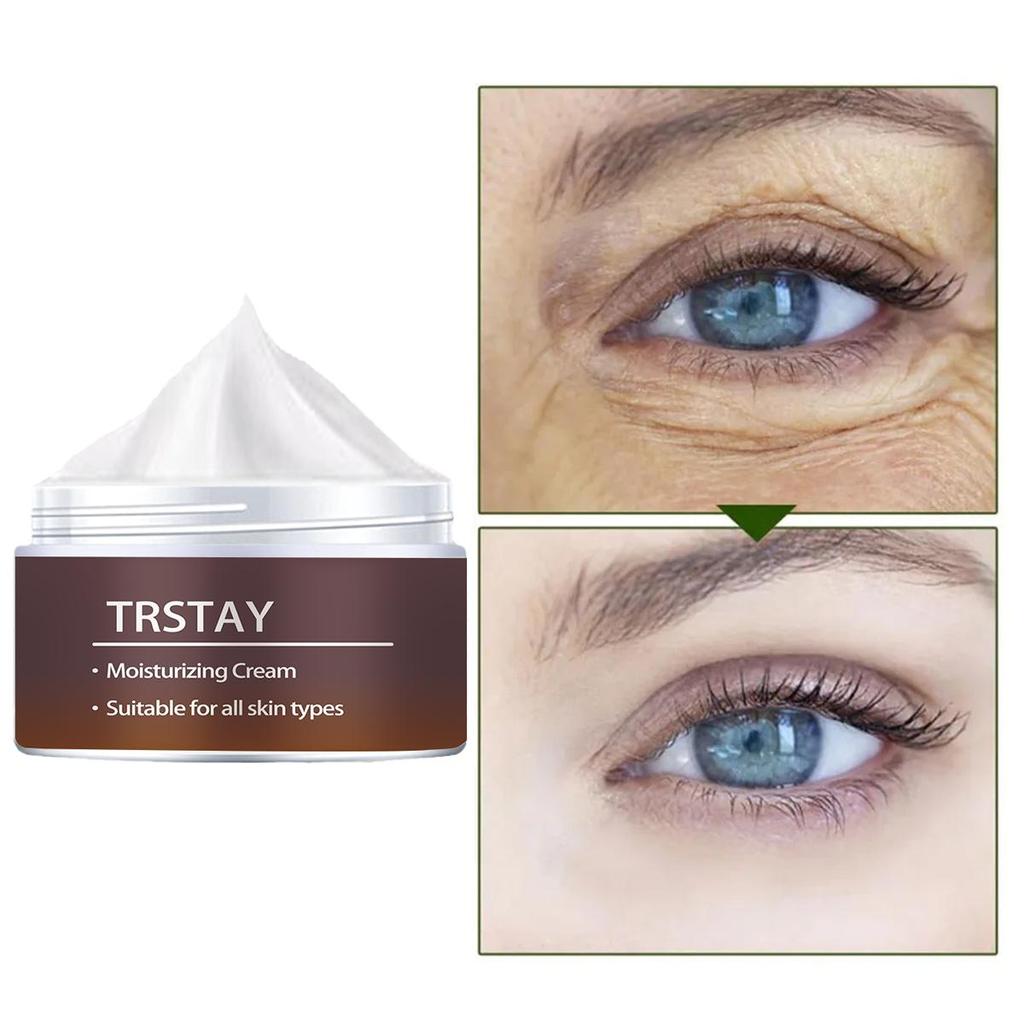 Creme zur temporären Entfernung von Tränensäcken. Strafft und festigt die Augenhaut sofort und beseitigt Augenringe.