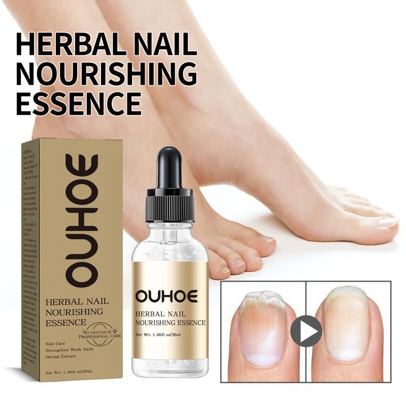 Nourishing Ouhoe Nail Care Essential Oil For Healthy Strong Nails And Cuticle Repair