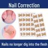 Natural Nail Repair and Correction Stickers with Pull Tabs for Toes
