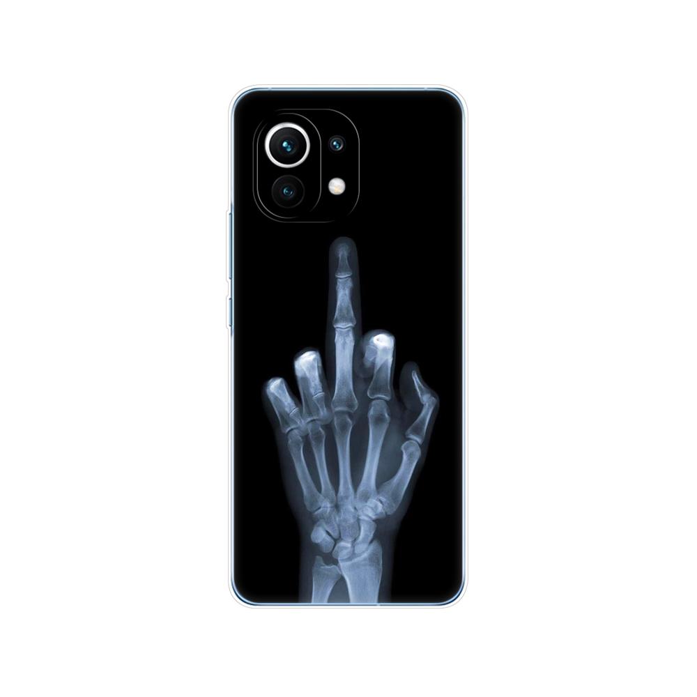 Für xiaomi Mi 11 | Mi 11 Lite 4G 5G NE| Mi 11i | Mi 11 Ultra Hülle Rückseite xiaomi11 i 11Lite Telefonhülle Xiomi Mi11Lite Silikon TPU