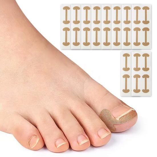 10Pcs Ingrown Toenail Correction Patches Nail Straightener for Pain Relief & Nail Recovery Ingrown Toenail Corrector Kit for Toenail Fungus