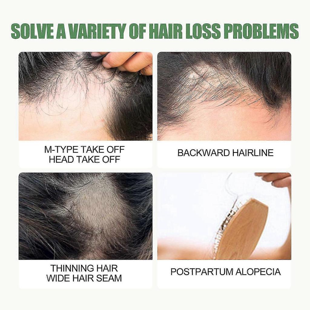 2 Pack Batana Oil for Hair Growth - Promotes Healthy Hair for Men & Women, Enhances Hair & Skin