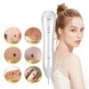 Small White Spot Removal Pen Advanced Laser Beauty Device For Home And Salon Use