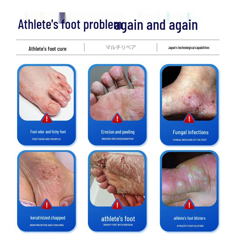 Miyamoto Tanaka Athlete's Foot & Foot Odor Treatment