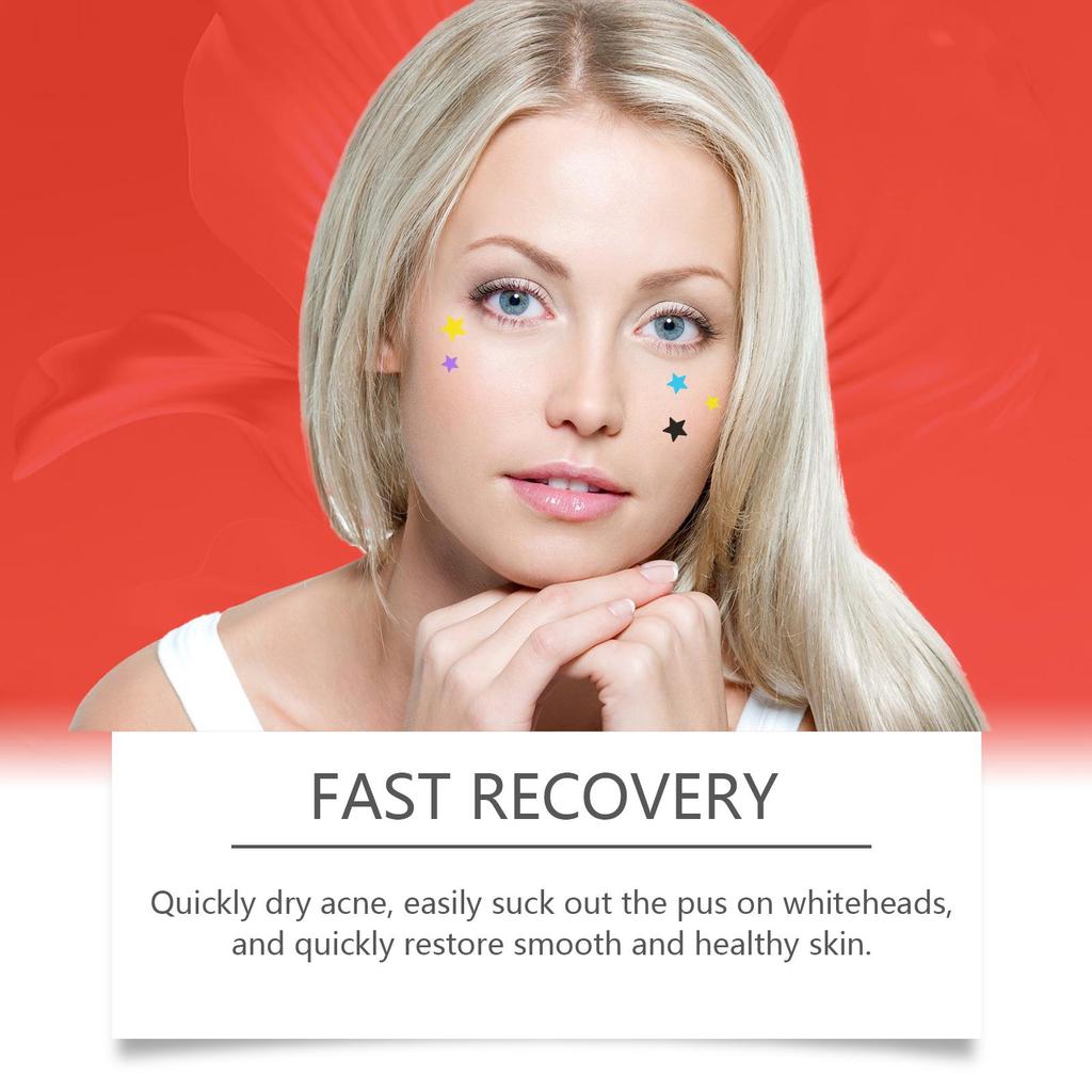 Jaysuing Acne Patches: Top-quality Hydrogel Acne Patches Designed Specifically To Reduce Acne and Whiteheads, 200 Pieces.