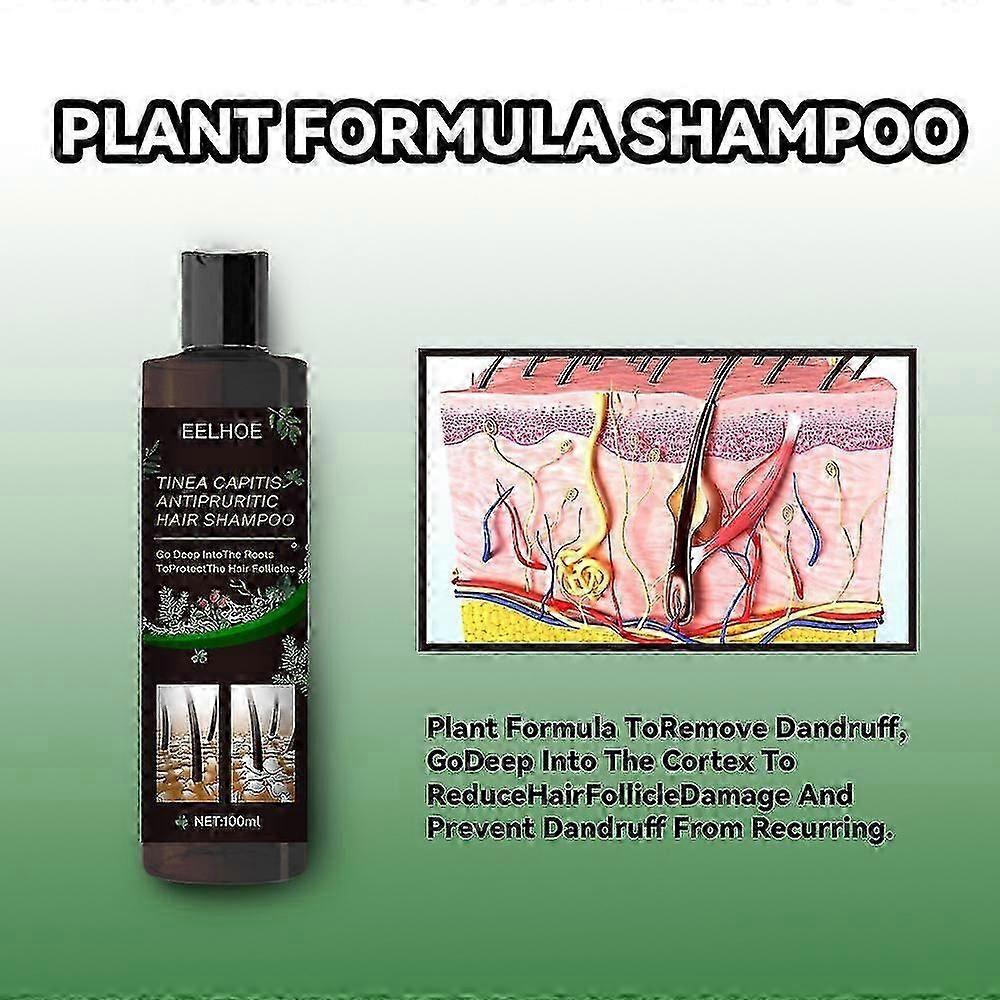 Mild Sulfate-Free Shampoo for Sensitive Scalps with Dermatitis Relief