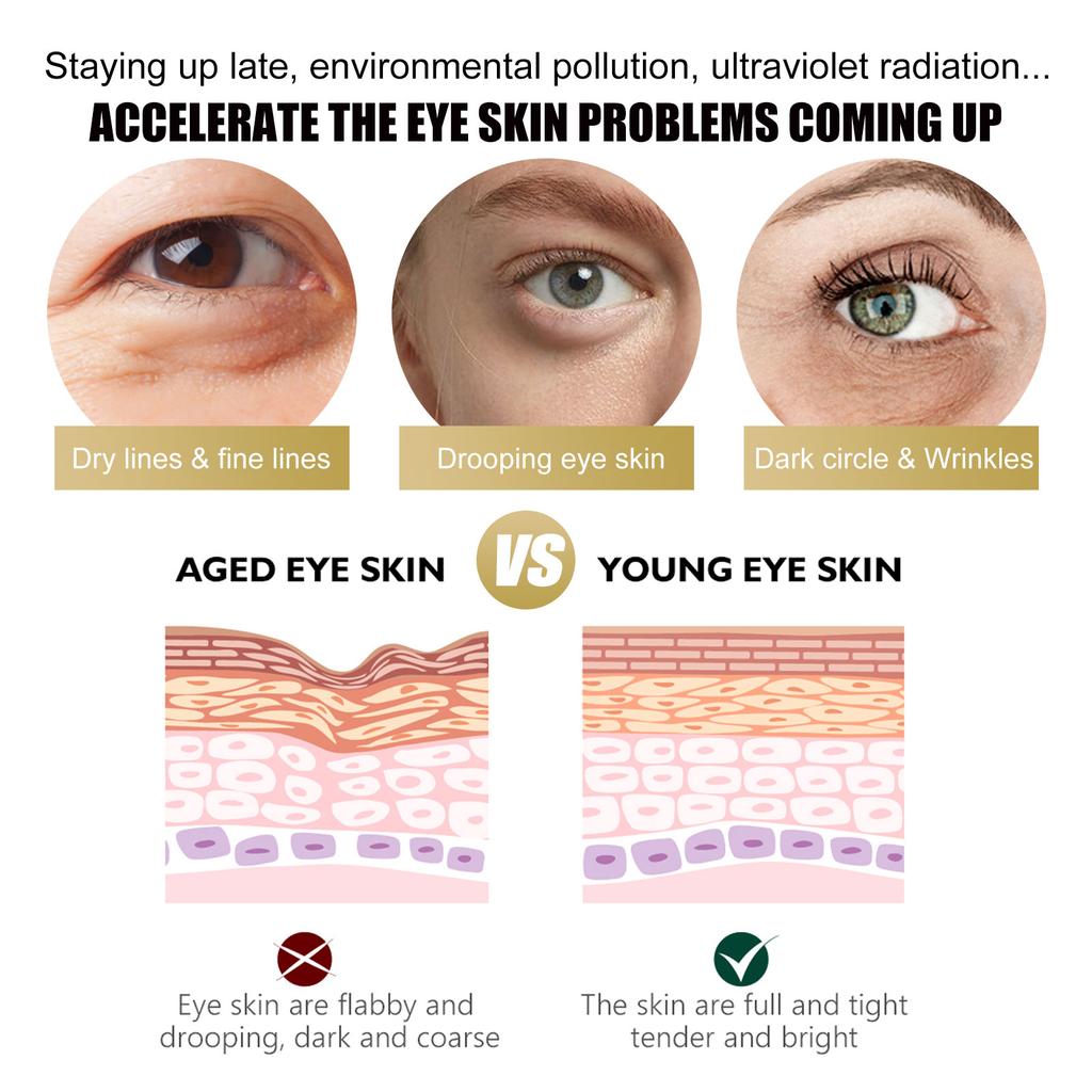 EELHOE Retinol Cream Stick Reduces Eye Bags Dark Circles Wrinkles Moisturizes And Tightenes The Skin Around
