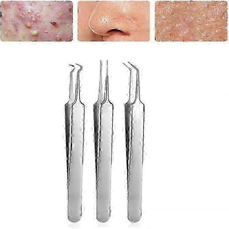 3-teilige Mitesserentfernungsklemme 8,7 cm, abgeschrägte Akneklemme aus Edelstahl, Baumwollpinzette, Schönheitsaknenadel, entfernt leicht winzige Akne, entfernt Akne blac