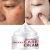 Facial Freckle Cream Targets Black Spots and Irregular Pigmentation To Reduce Black Spots Skin Whitening, Moisturizing