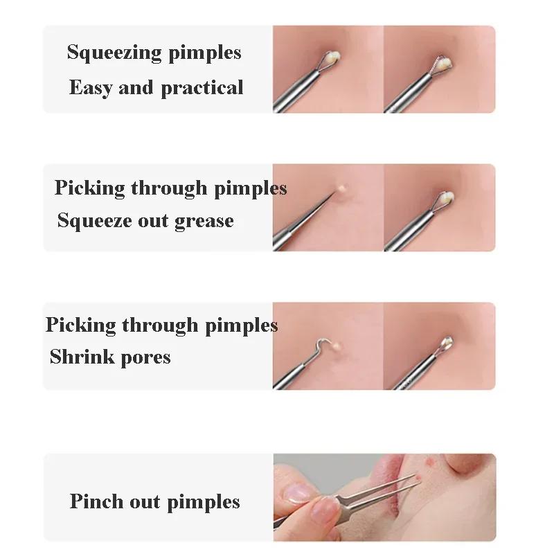 14PCS Higt Quality Acne Blackhead Removal Kit Nose Face Pore Cleansing Acne Needle for Ingrown Hair Comedones Extractor Skin Care Tool