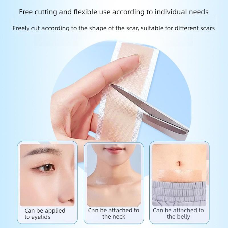 1/2/3Pcs 4cm Wide X1.5m Long Silicone Scar Management Skin Thicken Patch Tape Hypoallergenic Nursing Supplies for Scar Treatment