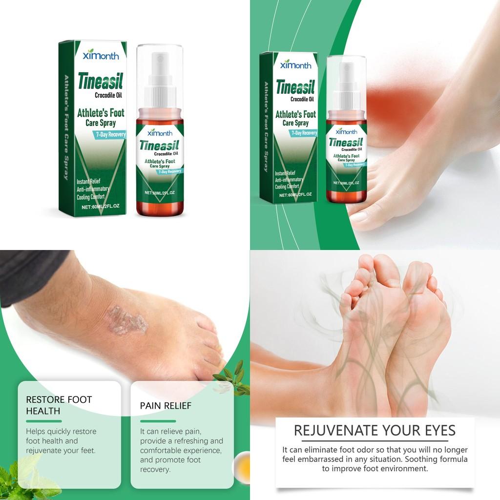 Ximonth Foot Skin Care Spray Nourishing Hydrating Refreshing Moisturizing Treatment For Soft Feet