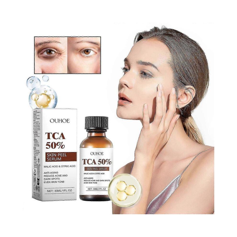 Citric Peeling Serum Chemical Peel for Face Peeling Solution Peel Chemical Exfoliant for Face Exfoliating Facial Peel for Dark 30ml