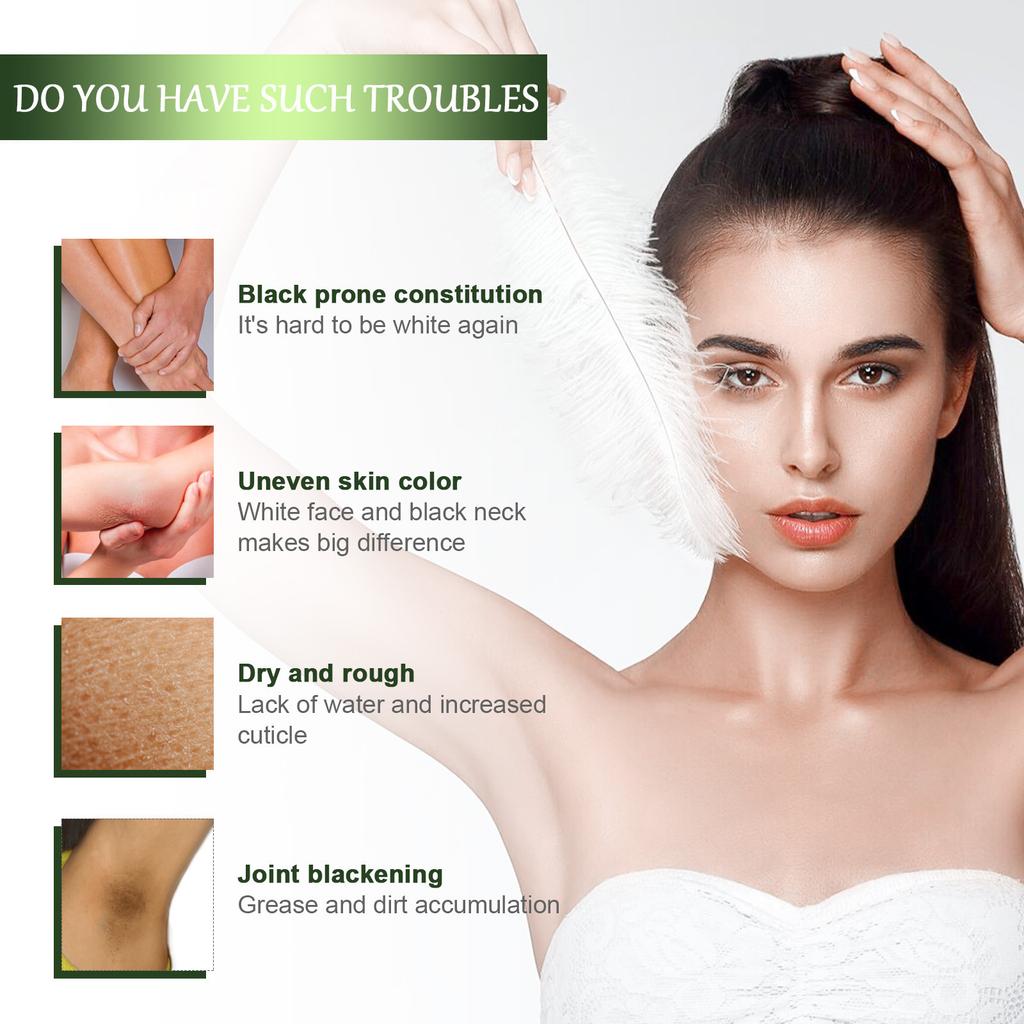 Kräuternährende Creme zur Aufhellung dunkler Haut an Gelenken und am Körper, feuchtigkeitsspendend und aufhellend, Körper- und Gelenkhautpflegecreme