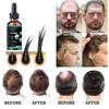 Saç Özü Yağı 5 Doğal Zencefil Saç Yağı Anti Saç Dökülmesini Önleme Kellik Tedavisi Hızlı Besleyici Saç Derisi Saç Bakımı