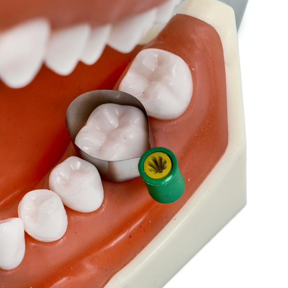 Fialová dentální super mat / Super cap matricový systém nástroj Adapt Super cap matrice držák Univerzální matricová napínací rukojeť nástroje