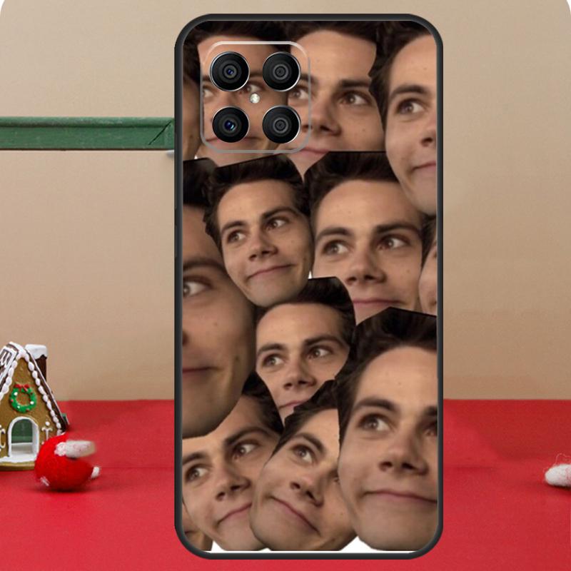 Dylan O'Brien Collage Teen Wolf Case For Honor Magic 8 Pro 6 7 Lite Honor 400 200 50 70 X8c X8b X9a X9b X9c X9d Win RT Coque