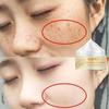 Facial Dark Spots, Dark Spot Correction Creams, Serums, Rich Skin Care, Targeting All Skin Tones, Skin Blemishes, Wrinkles