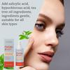Hypochlorous Acid Facial Spray Reduce Redness Swelling Acne Pimple Repairing Soothing Oil Control Pore Refining Calm Skin Care