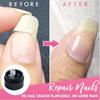 Broken Nail Nail Recovery Nail Strengthener Cracks Nail Fix Nail Instant Cracked Nail Repair Gel