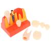 Dental 4Times Implant Teaching Model Removable Crown Bridge Demonstration Dental Doctor-Patient Communication Teaching Aid