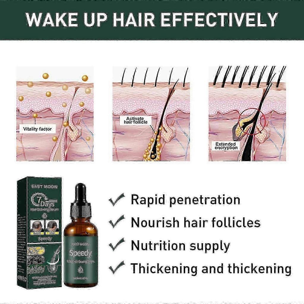 7days Hair Growing Serum, Anti-detachment,hair Development30ml