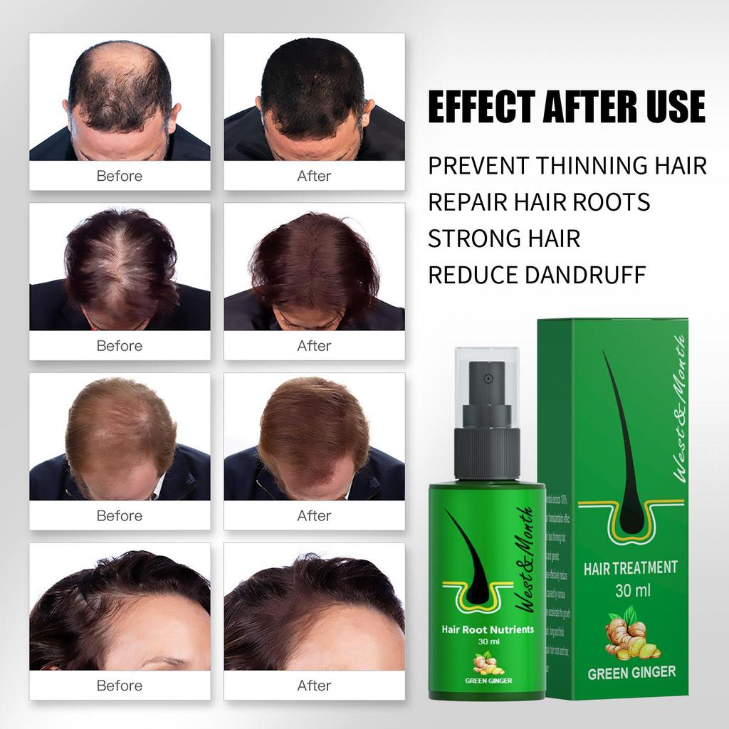 West&Month Ginger Hair Care Spray, strengthens hair, prevents thinning, frizz, repairs hair roots, reduces dandruff, and helps prevent hair loss  30ml